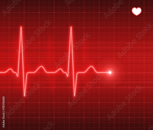 Heart pulse, electrocardiogram