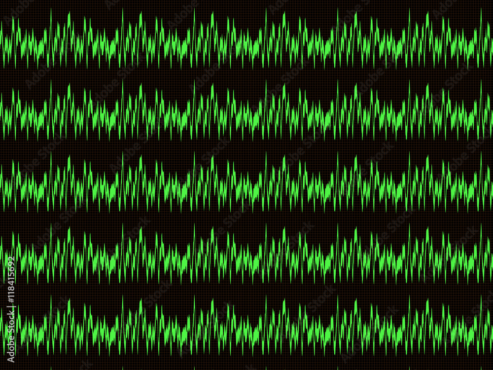Several horizontal green waveform on the oscilloscope screen with the checkered marking Several horizontal green waveform on the oscilloscope screen with the checkered marking