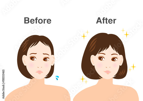 薄毛に悩む女性のイラスト: ビフォーアフター