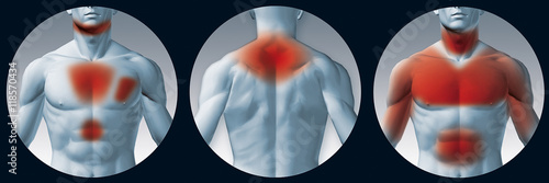 Different areas of pain or symptoms when experiencing a heart attack