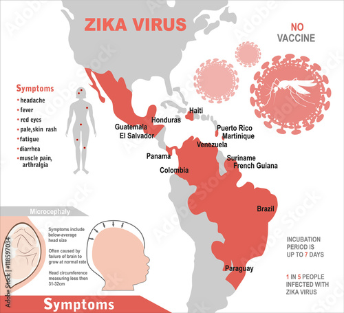 Zika virus infographic elements - prevention, transmission, vaccine, symptoms, microcephaly, protection measures. Zika virus disease. Zika virus design template. Isolated vector illustration.