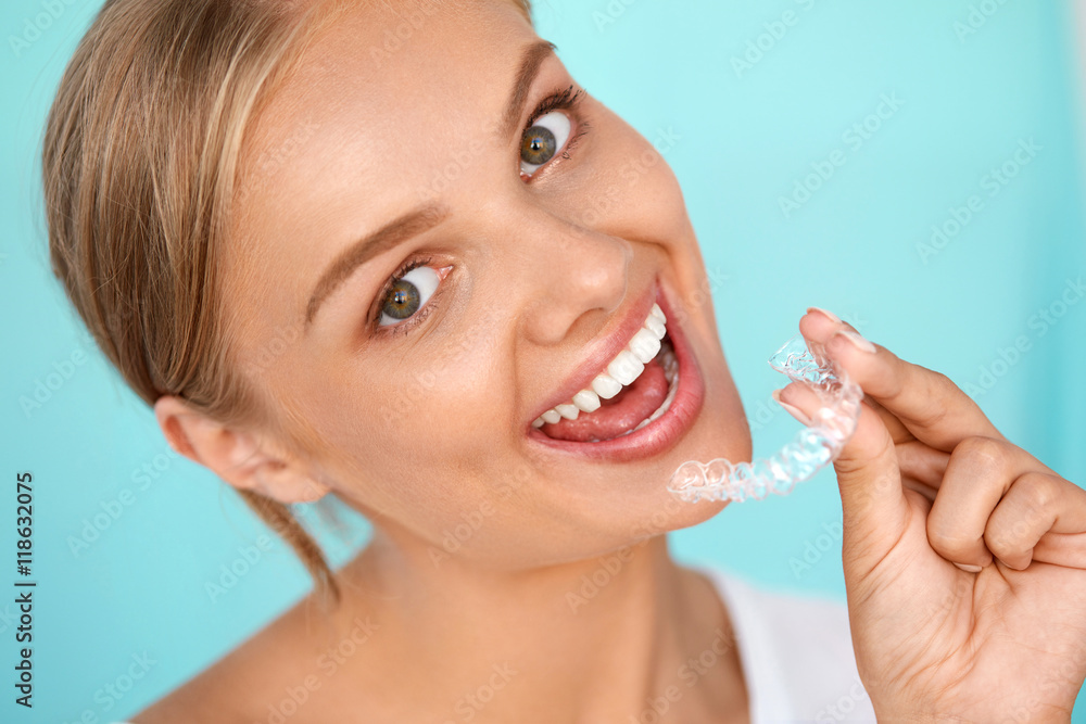 Smiling Woman With White Teeth Holding Teeth Whitening Tray. High Resolution Image Smiling Woman With White Teeth Holding Teeth Whitening Tray. High Resolution Image