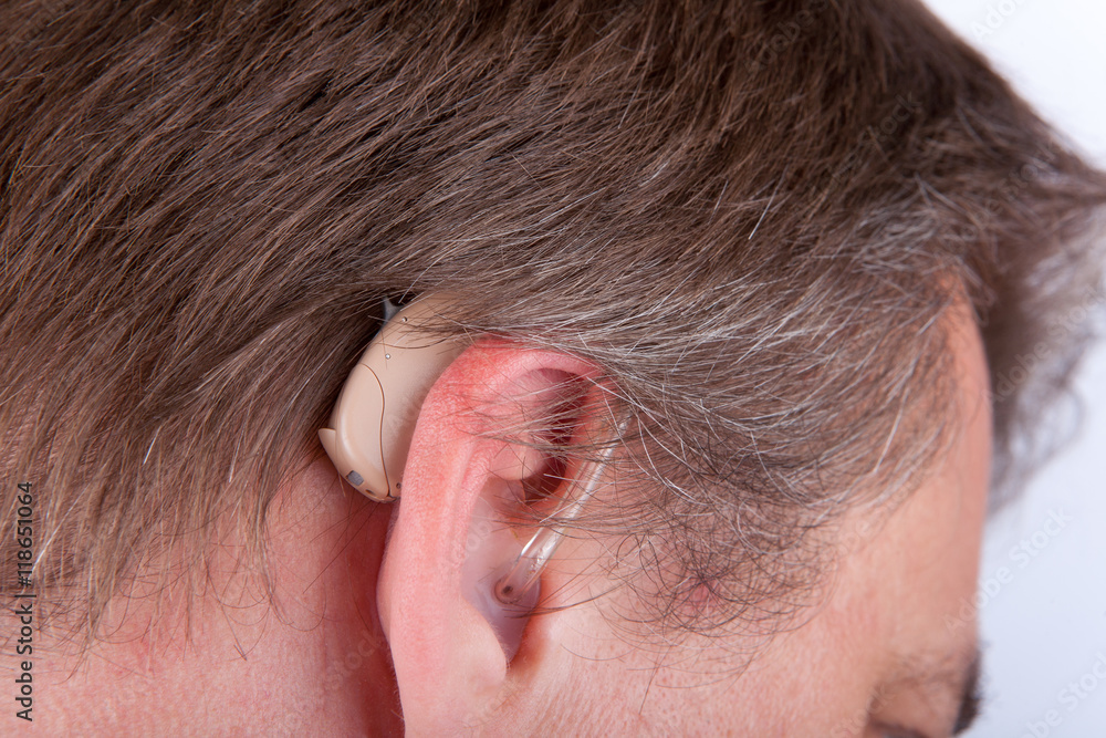 Obraz premium Ear and hearing aid