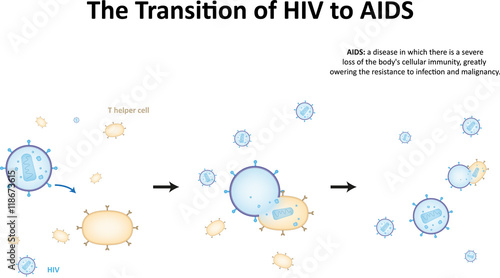 The Transition of HIV to AIDS