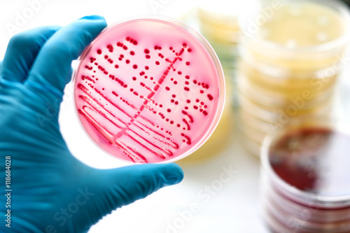 Colonies of bacteria in MacConkey agar 