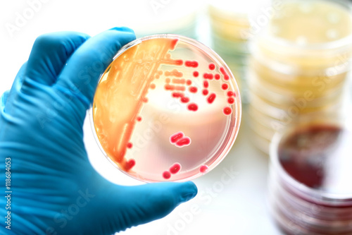Colonies of bacteria in MacConkey agar 
 photo