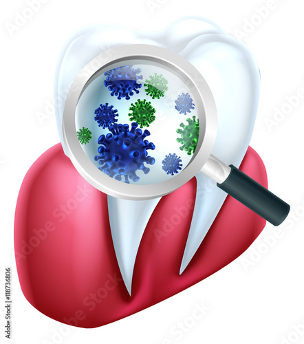 Tooth and Gum Bacteria