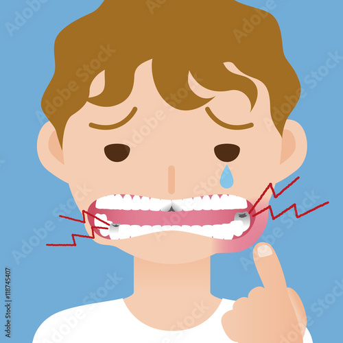 toothache, hurts of bad tooth, stomatitis, mouth ulcer, periodontal disease, vector illustration