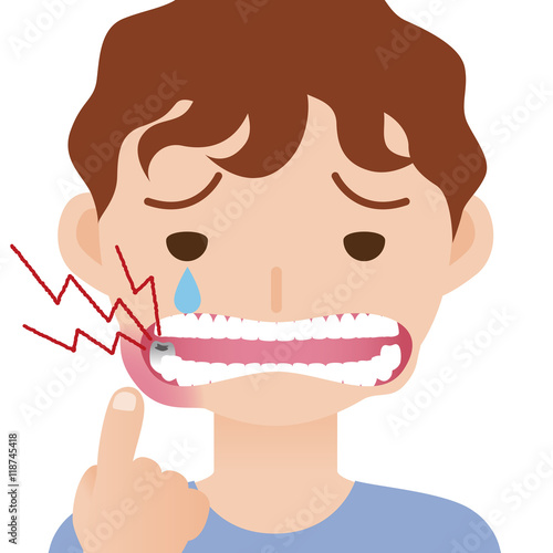 toothache, hurts of bad tooth, stomatitis, mouth ulcer, periodontal disease, vector illustration