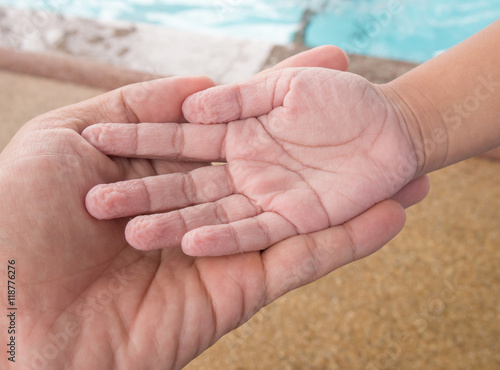 Children 's hand from play in the water for a long time ,withered hands. Education Concept.