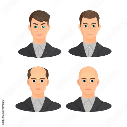 Alopecia concept. Set of heads showing the hairloss progress.