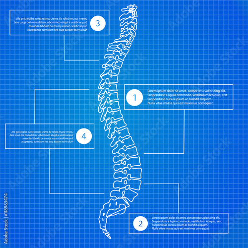 Beautiful timeline infographic medic spine human on the blueprint background. Clean and elegant style