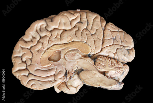 Bild auf Leinwand Real human half brain anatomy isolated on black background
