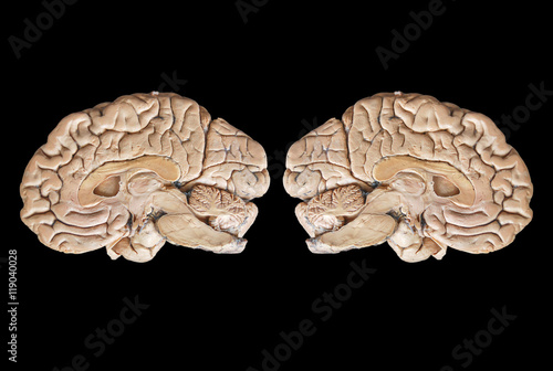 Real human half brain anatomy isolated on black background