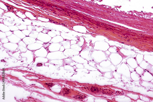White adipose tissue, light micrograph, hematoxilin and eosin staining, magnification 100x. Fat cells (adipocytes) have large lipid droplet which remains unstained photo