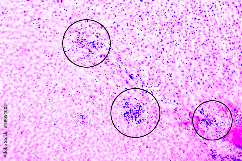Coccidiosis, coccidia in liver (marked with circles), illustration