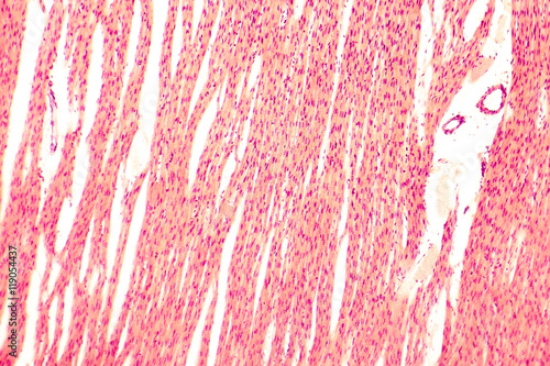 Heart muscle, light micrograph. Striated cardiac muscle cells (myocytes). Light microscopy, hematoxilin and eosin stain, magnification 100x