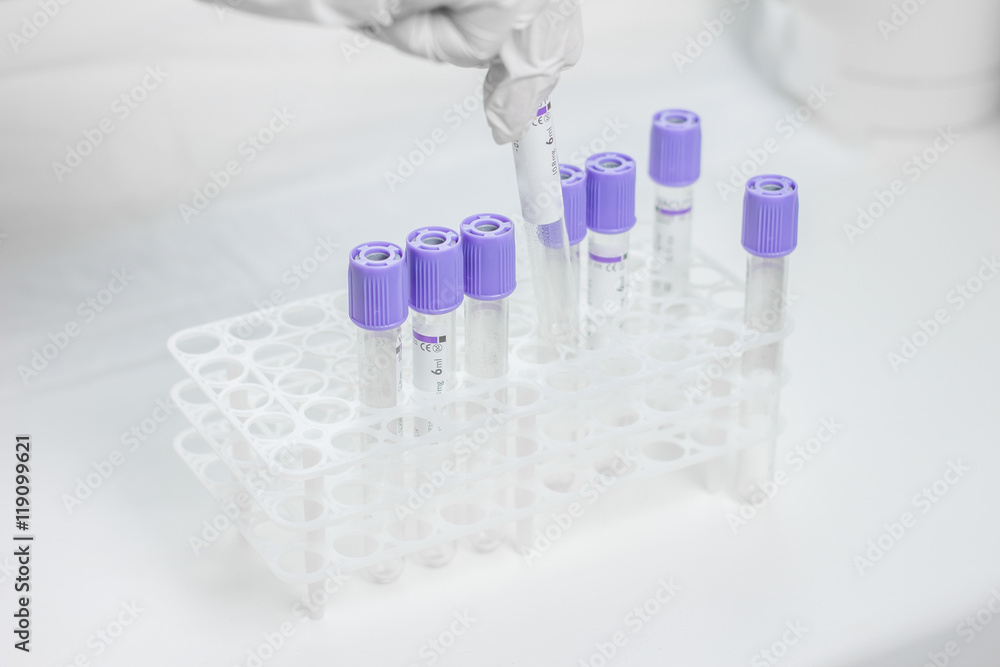 tubes for blood sampling tubes for blood sampling