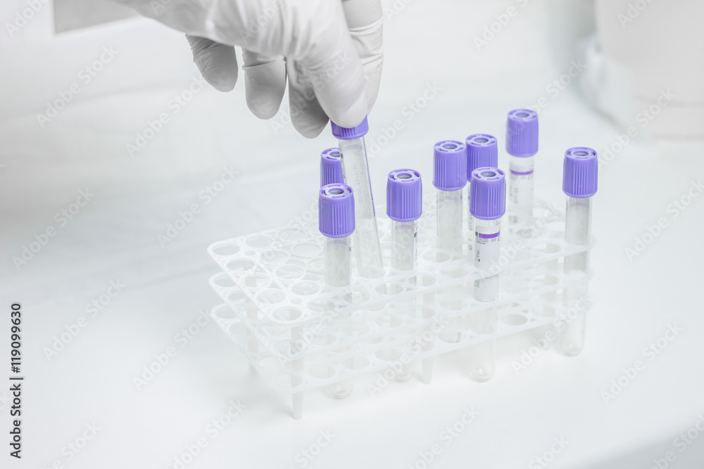 Fototapeta premium tubes for blood sampling