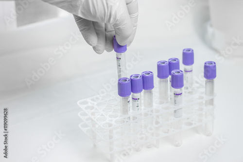 tubes for blood sampling
