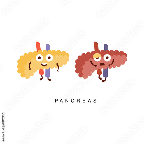 Healthy vs Unhealthy Pancreas Infographic Illustration