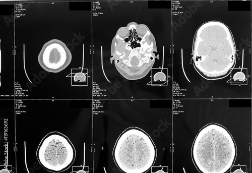 Scanner head of a young woman