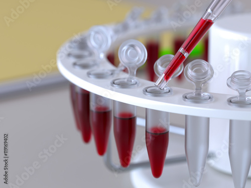 Laboratory blood test photo