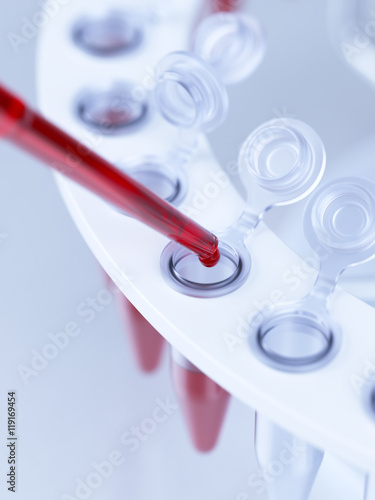 Laboratory blood test