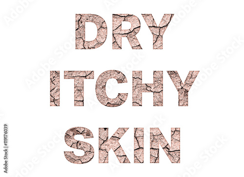 Dry Itchy skin word concept on white background