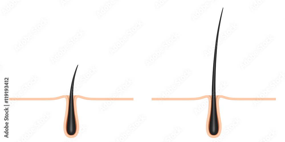 Ταπετσαρία hair follicle. cross section.