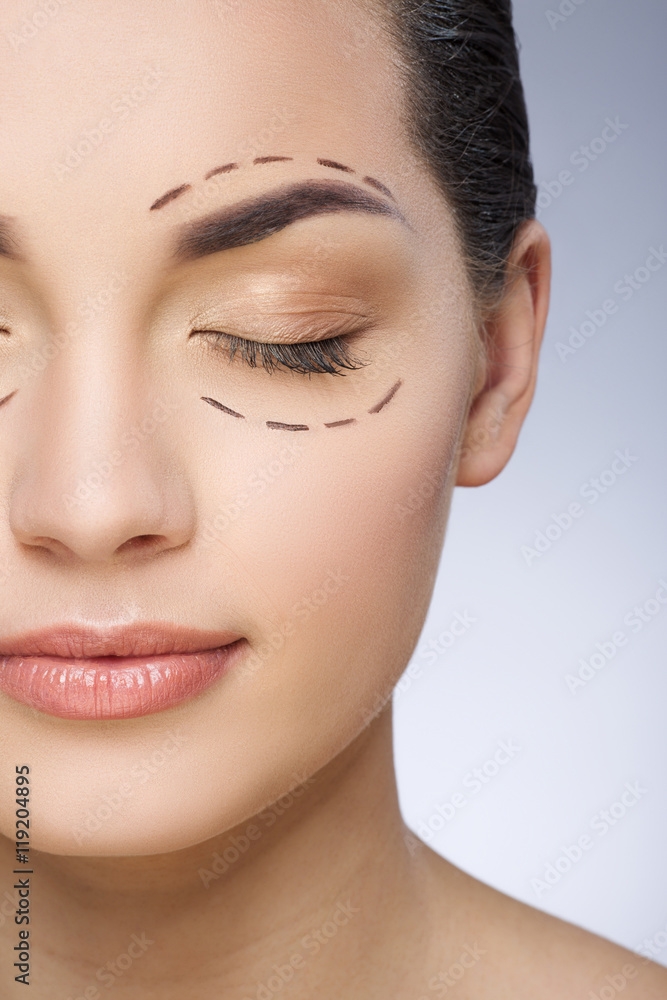 Girl with dashed lines around closed eyes Girl with dashed lines around closed eyes