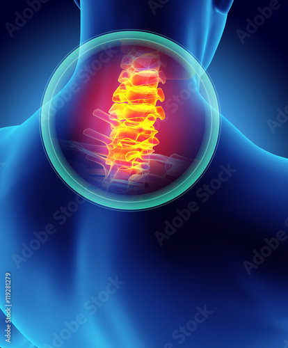 Neck painful - cervica spine skeleton x-ray, 3D illustration. photo