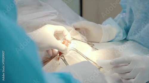 electrosurgery tool in surgeon's hand photo