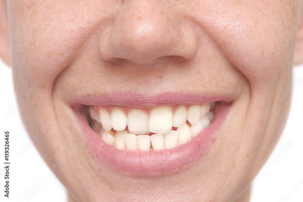 Fototapeta premium kobieta krzywe zęby