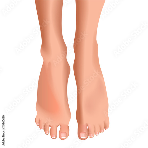 Vector illustration of female feet isolated on white background realistic