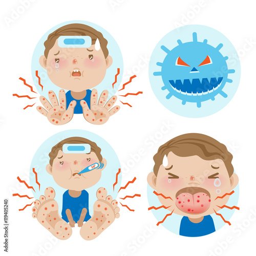 HFMD  children infected. hand foot and mouth disease.Cartoon vector illustration