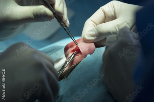 Ear Surgery Detail