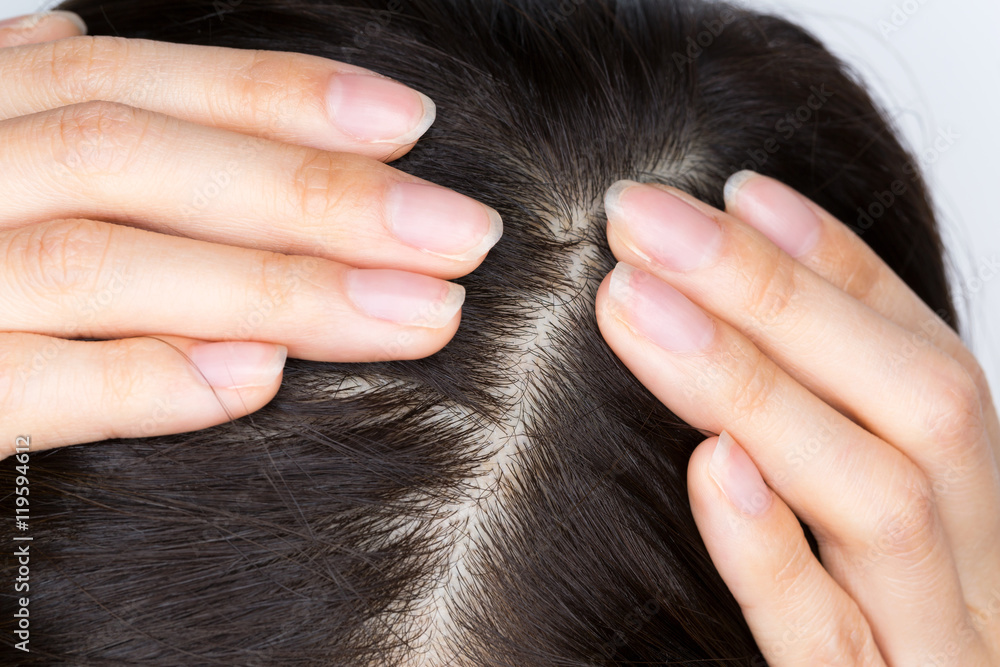 Fototapeta premium 頭皮ケア
