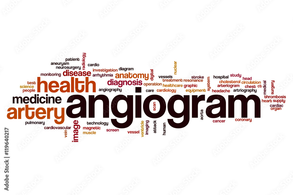 Angiogram word cloud Angiogram word cloud