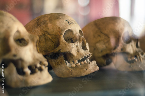 Skulls of dead people