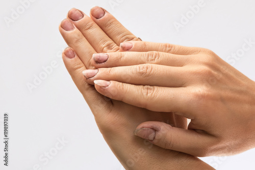 Bild auf Leinwand Female hands with dirty nails