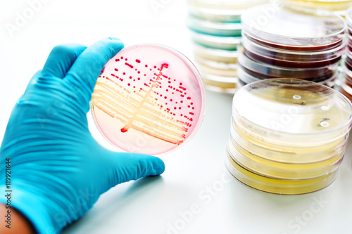 Bacteria culture in petri dish
 photo