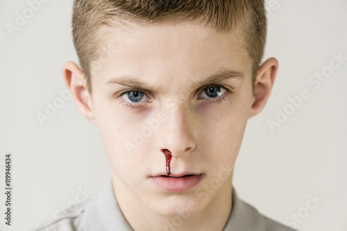 Foto Blood trickles from nose of male child on grey