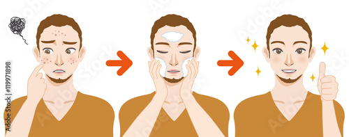 young boy acne treatment before and after, facial cleansing foam, men's skin care, cartoon illustration