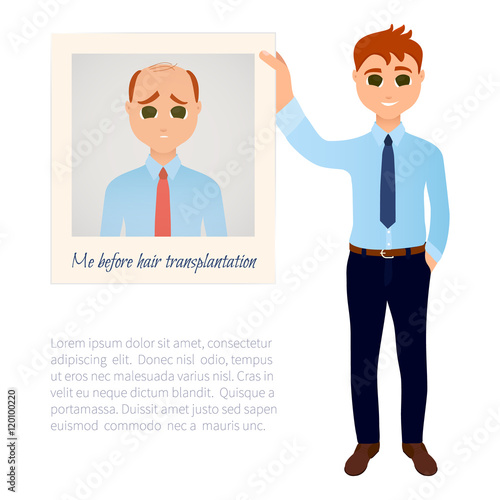 Man with great thick hair showing his old photo before hair treatment and hair transplantation. Male hair loss design template. Before and after medical concept. Vector illustration.