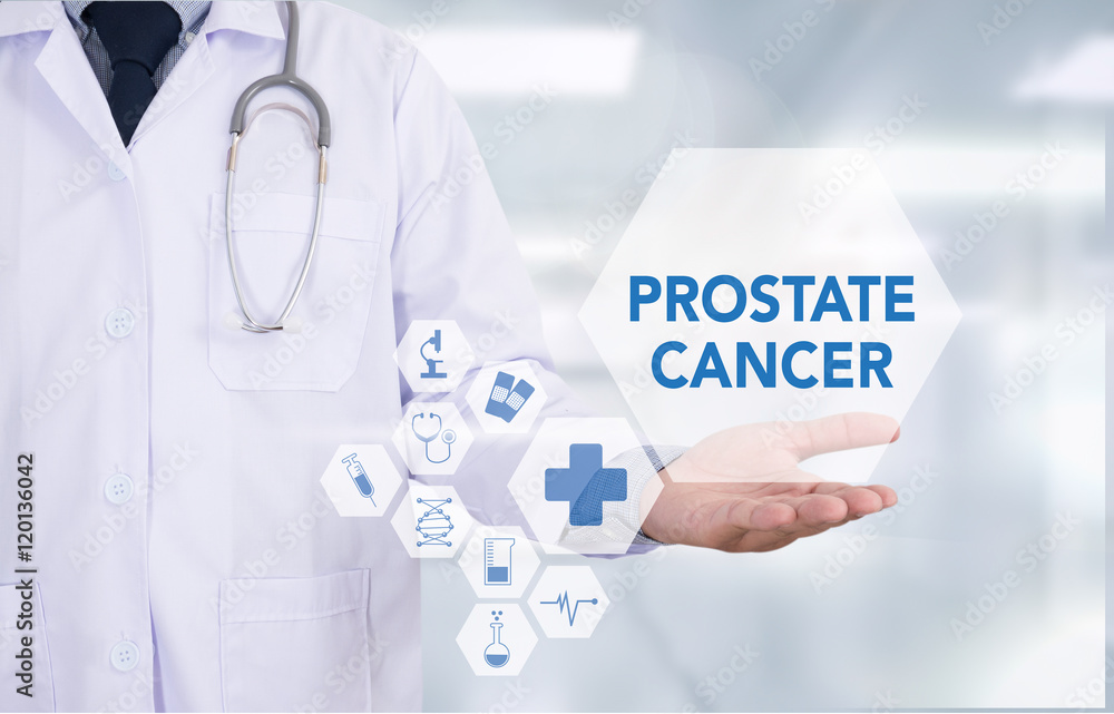 PROSTATE CANCER PROSTATE CANCER