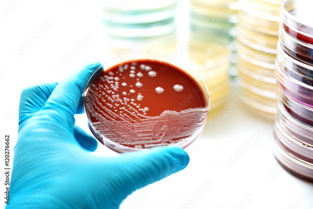 Colonies of bacteria in chocolate agar (culture medium plate) Stock