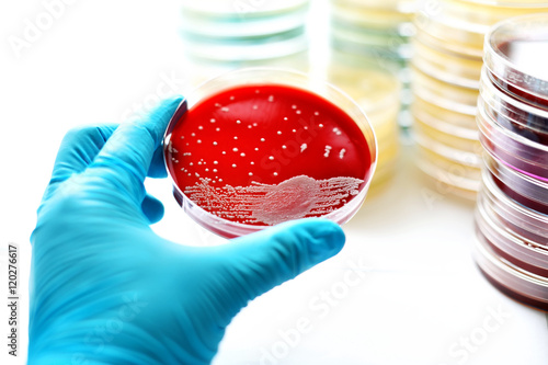 Canvas Print Colonies of bacteria in blood agar (culture medium plate)