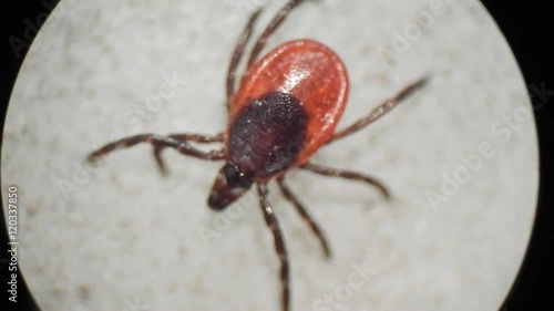 Taiga tick under microscope
