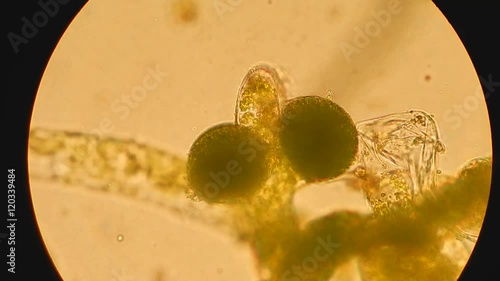 Seaweed (algae) under microscope, magnification 400x photo